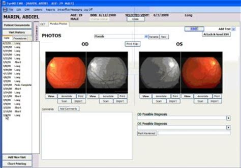 optometry emr systems.